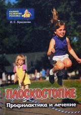 Плоскостопие у детей скачать