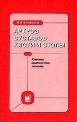 Артроз суставов кисти и стопы: клиника, диагностика, лечение скачать